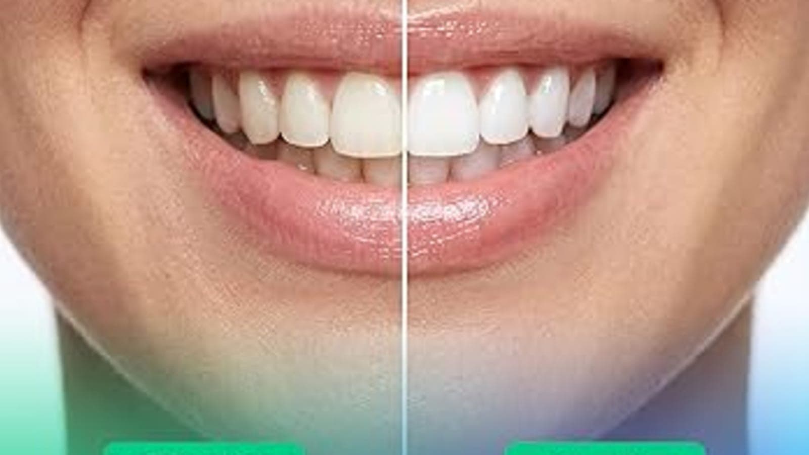 Puur Smile: Redefining At-Home Oral Wellness with Smarter, Healthier Smiles Introduct
